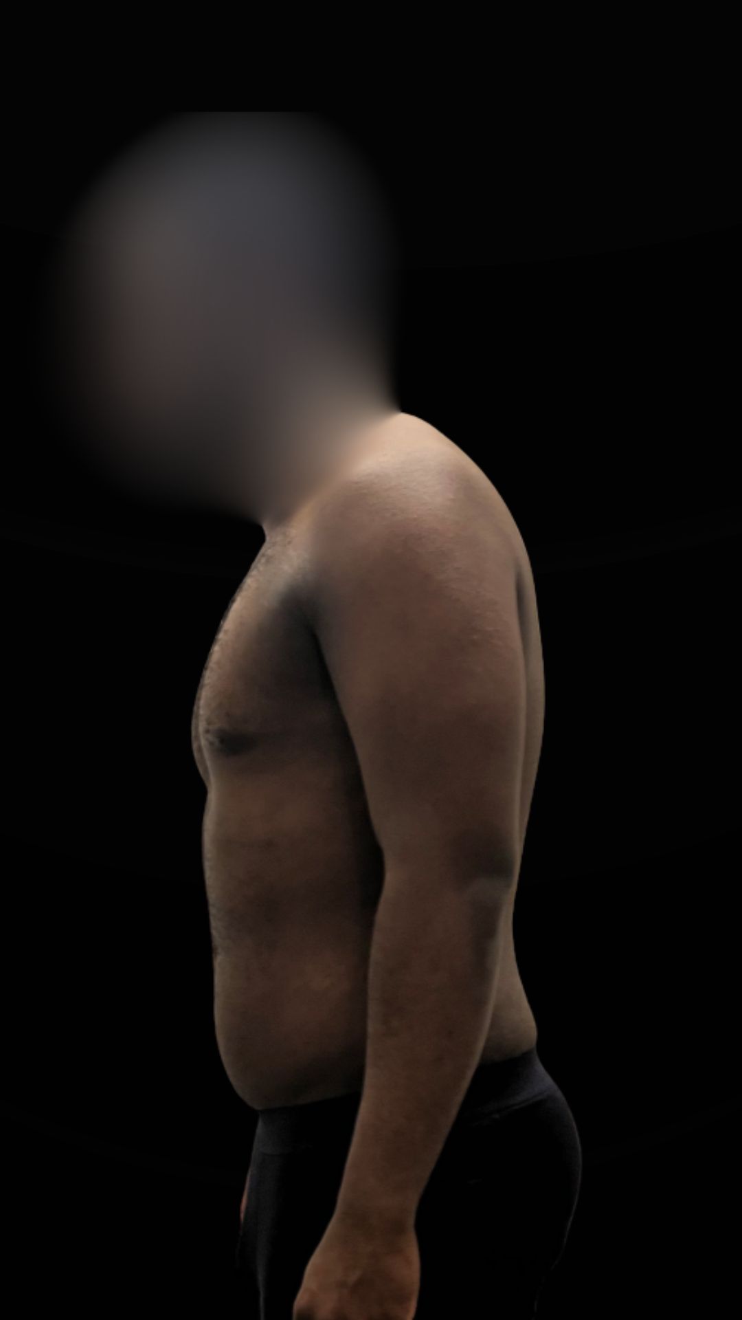 Thibault après